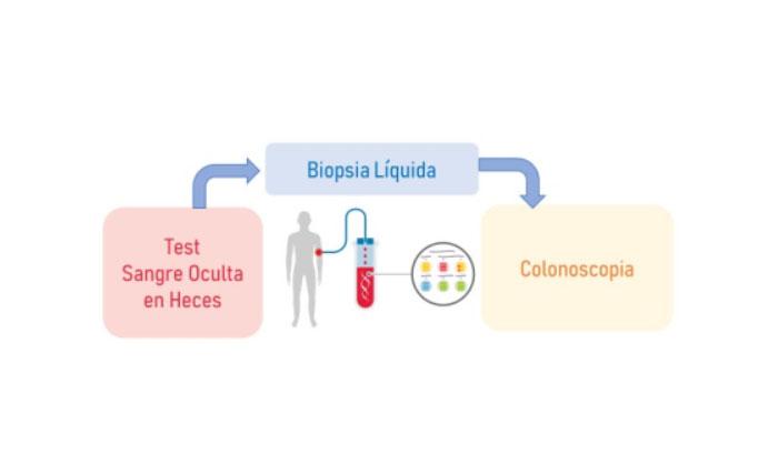 Imagen Biosensor para el diagnóstico no invasivo de cáncer colorrectal