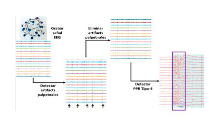Imagen Análisis de Electroencefalogramas Mediante Técnicas de Inteligencia...
