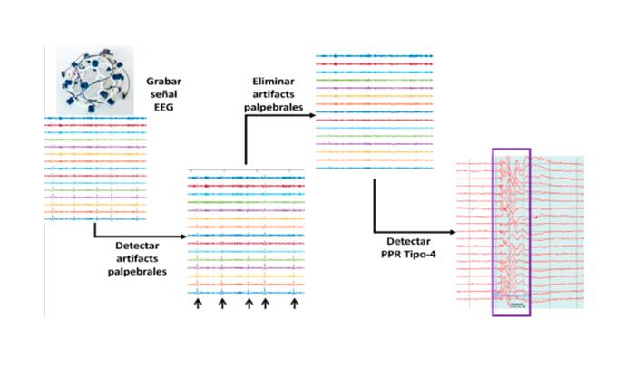 Imagen Análisis de Electroencefalogramas Mediante Técnicas de Inteligencia Artificial para la Mejora del Diagnóstico de Patologías Neurológicas (IA4EEG)