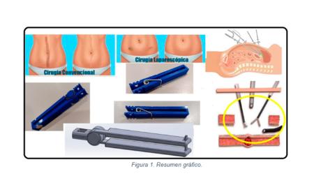 Imagen Diseño de mecanismos de ayuda a la cirugía abdominal por endoscopía....