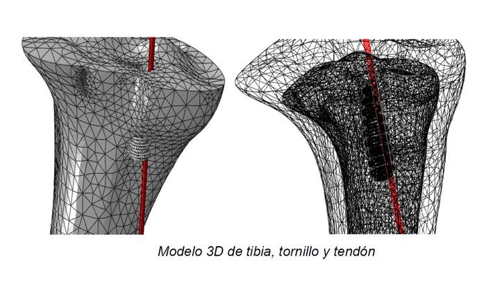 Imagen Caracterización mecánica y optimización numérica del comportamiento biomecánico de las reconstrucciones del ligamento cruzado anterior mediante tornillo interferencial