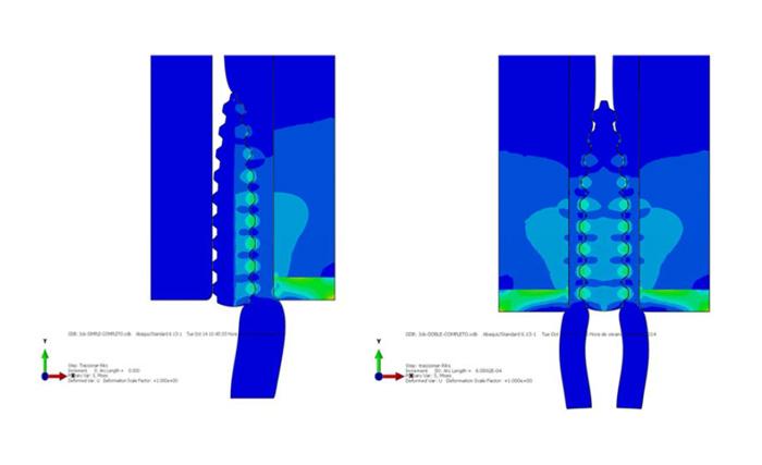 Imagen Influencia de la geometría y tipo de fijación en el comportamiento biomecánico de las reconstrucciones del ligamento cruzado anterior, mediante la utilización de métodos numéricos y experimentales